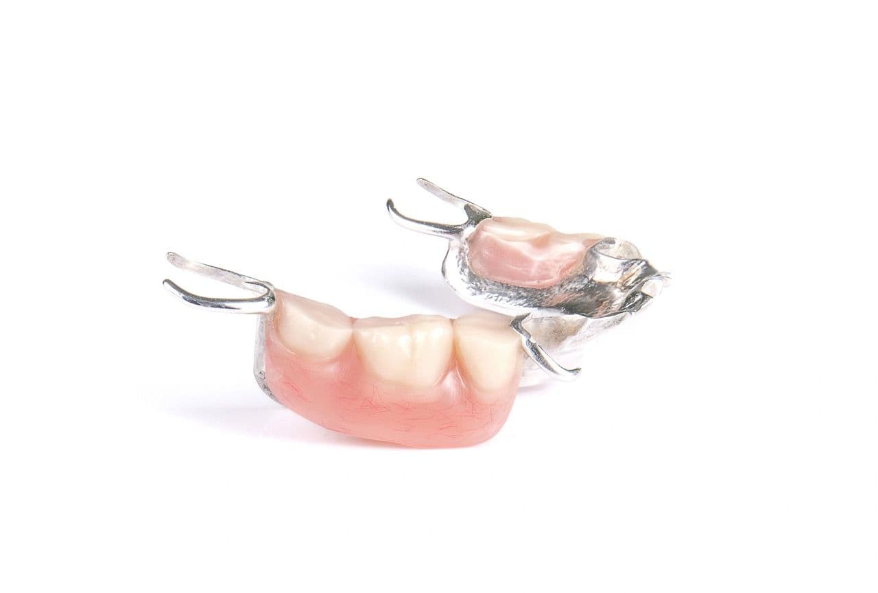 Photo of a partial denture.