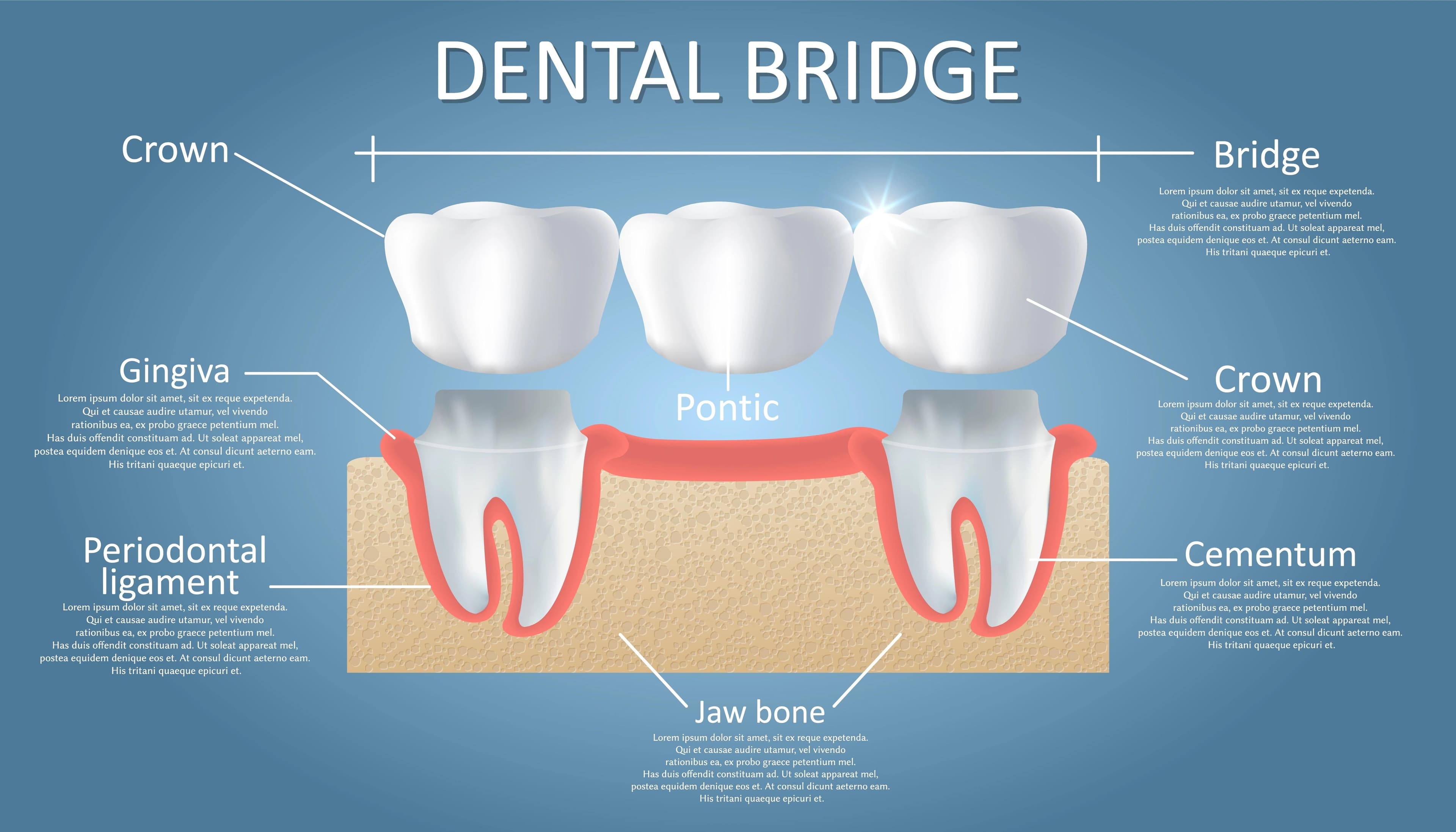 Infographic explaining the parts of a tooth.
