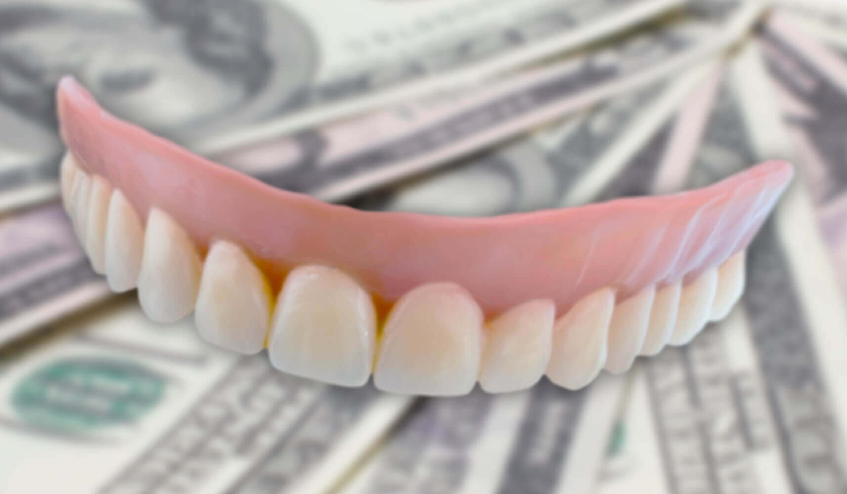 Cost of Full Mouth Dental Implants Affordable Dentures & Implants